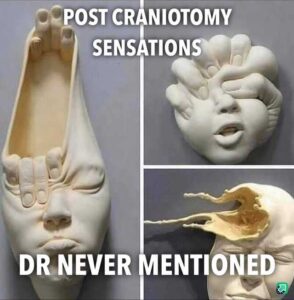 post craniotomy sensations humor