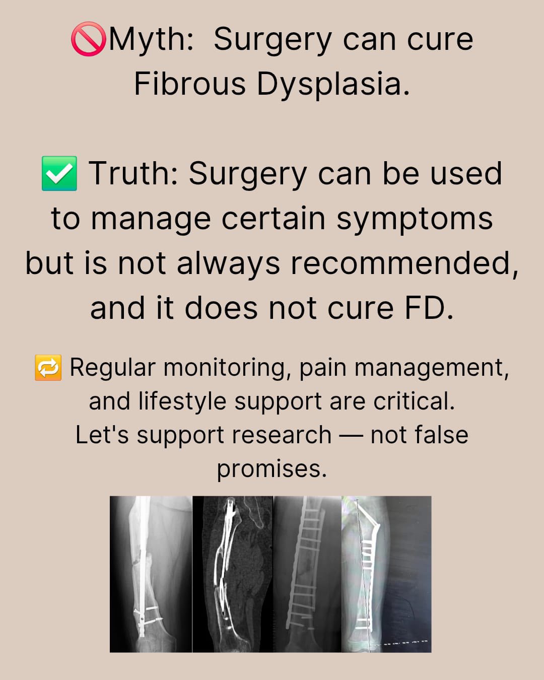 FDMAS Surgery