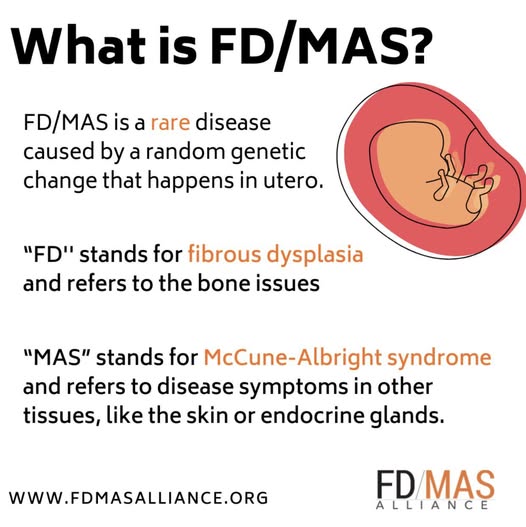 What is FDMAS